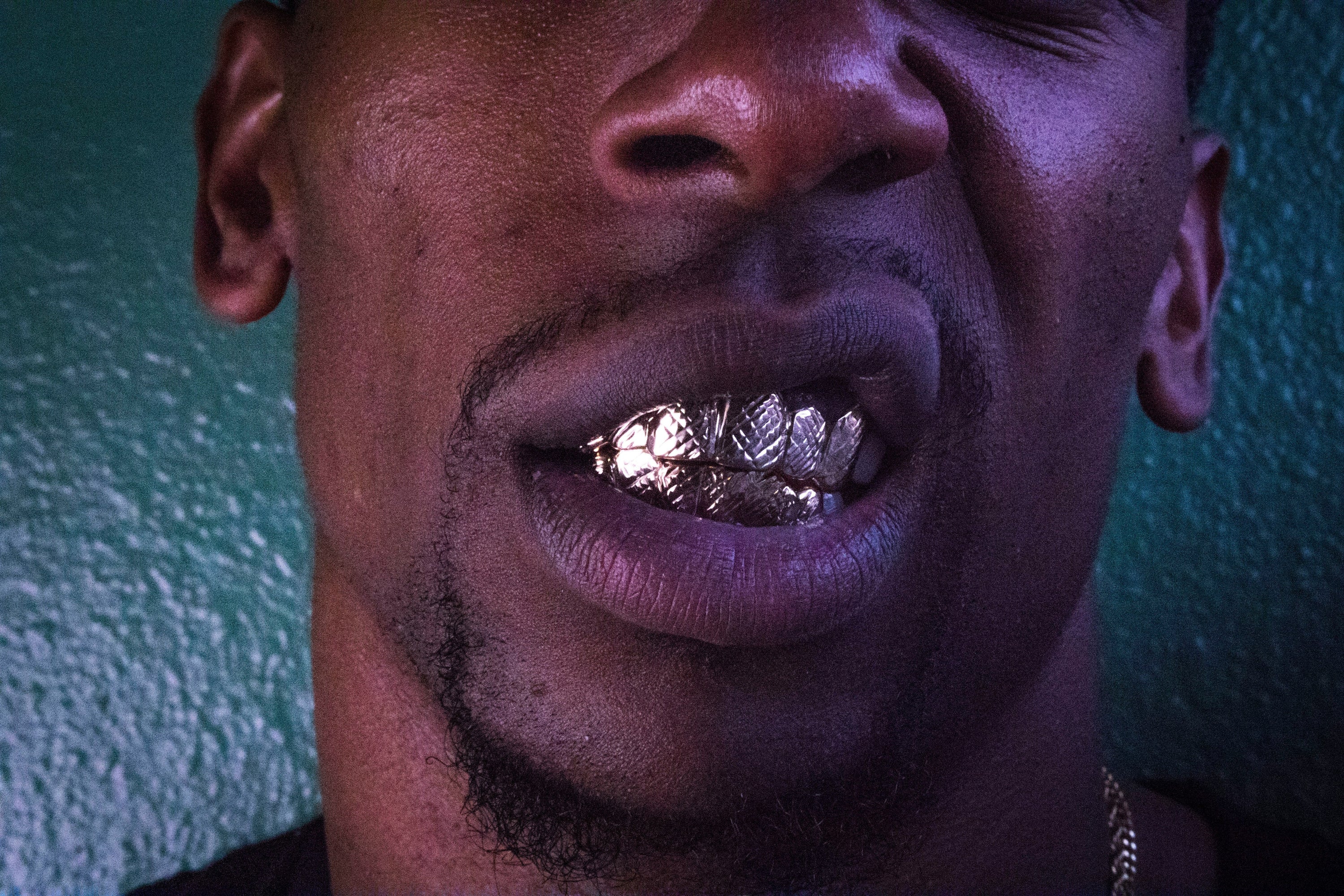 Est-ce que les grillz abîment les dents ? La vérité expliquée par des experts