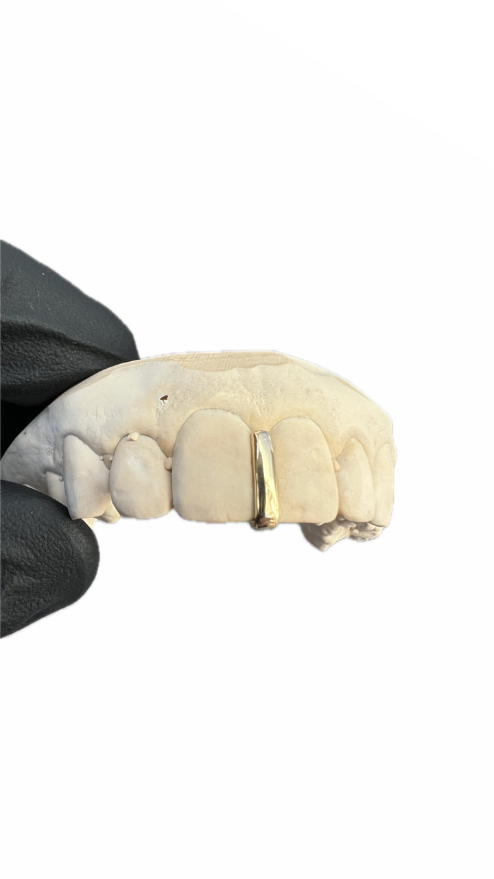 Interstice Classique